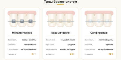 Сколько стоит установка брекетов в Москве