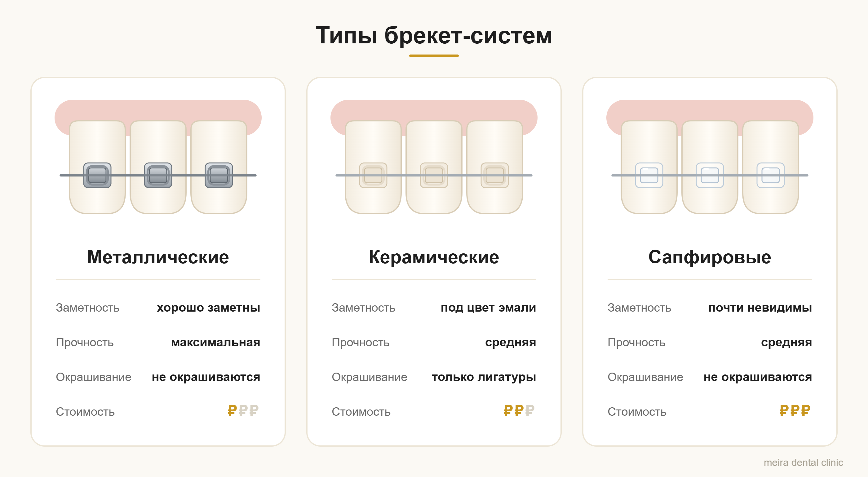 Стоимость установки брекетов: схема типов брекет-систем